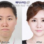 レス3番の画像サムネイル