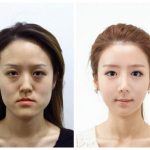 レス3番の画像サムネイル