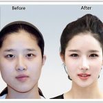 レス3番の画像サムネイル