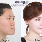 レス3番の画像サムネイル