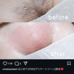 レス2番のサムネイル画像